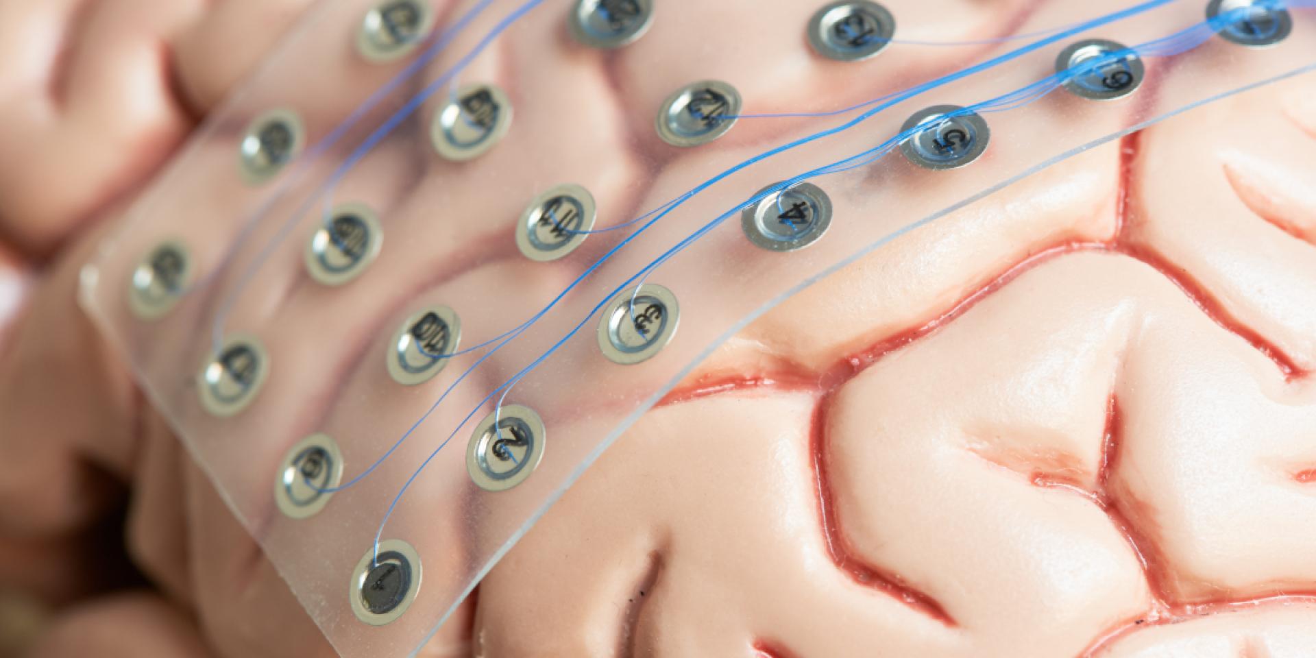 a model brain with a patch of sensors in a circuit - bioeletronics