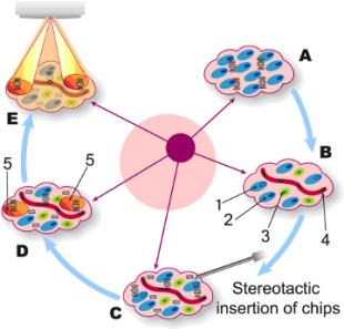 Implantable Microsystems for Personalised Anti-Cancer Therapy